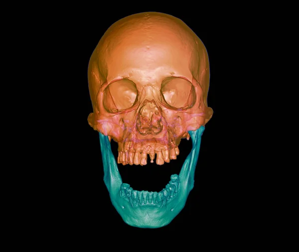 Ilustración Representación Cráneo Humano Naranja Mandíbula Verde Abiertos Vista Frontal —  Fotos de Stock