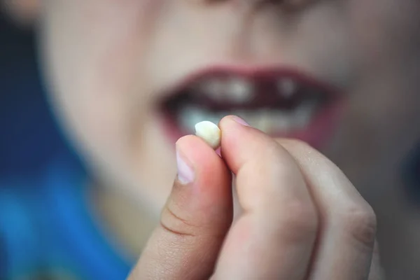 Proud young boy (age 6) holds his falling milk teeth. Childhood healthcare concept. Real people.