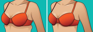 Kavram silikon meme ve plastik cerrahi.