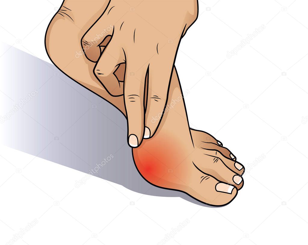 Bunion at sides of foot.