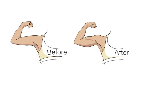 Spor öncesi ve sonrası kadın pazı ları ve trisepsleri. Fitness sonrası ilerleme gösteren kollar. Yarasa kanadı vs iyi tonda kol ile Bükülmüş kol. Güzellik, kozmetoloji için vektör illüstrasyon