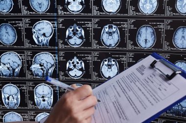 Manyetik rezonans taraması beynin. MRI kafa tarama.