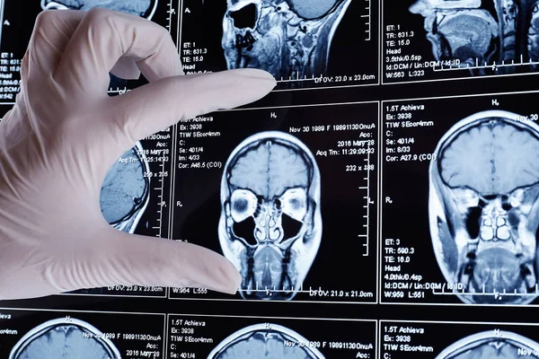 Magnetic resonance scan of the brain. MRI head scan.