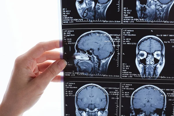 Magnetisk Resonanstomografi Scan Hjärnan Mri Huvud Scan — Stockfoto