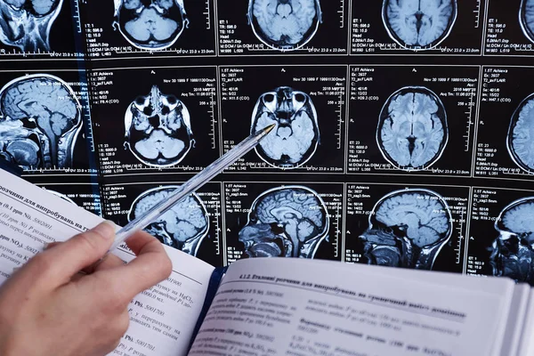 Magnetresonanztomographie Des Gehirns Mri Kopf Scan — Stockfoto