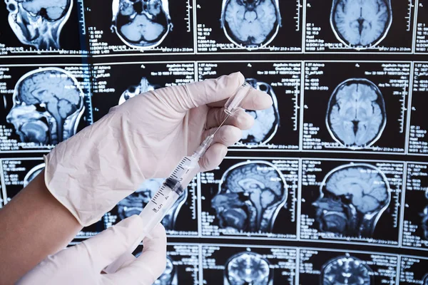 Magnetische Resonantie Scan Van Hersenen Mri Hand Syringe — Stockfoto