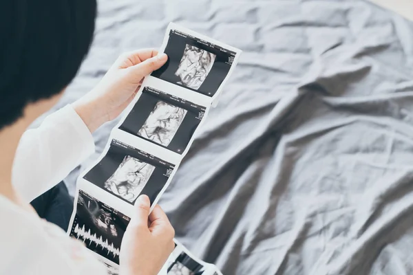 Joven Hermosa Mujer Embarazada Asiática Con Película Ultrasonido Punto Enfoque — Foto de Stock