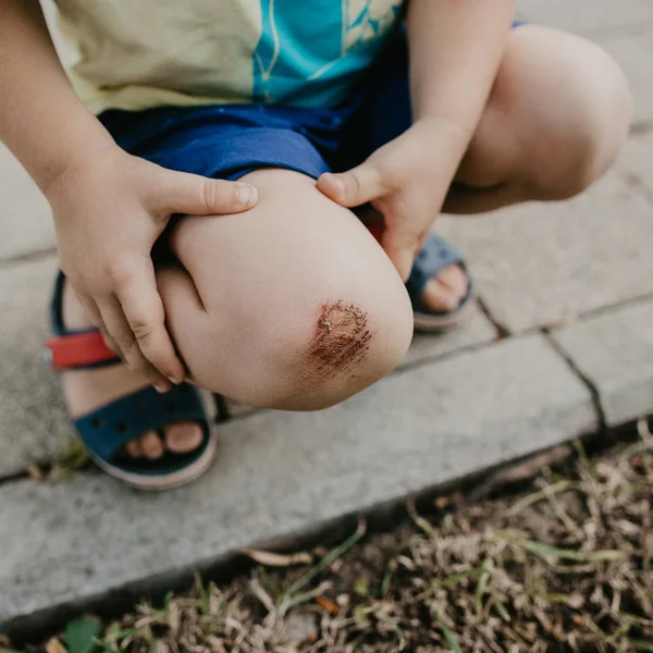 çocuk kaldırıma onun diz zarar. aşınma.