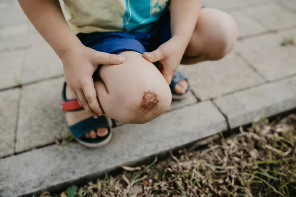 çocuk kaldırıma onun diz zarar. aşınma.