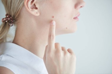 Cilt sorunları. Kız aynaya bakıyorum