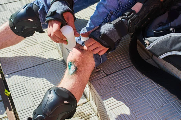 Pria Dalam Sepatu Roda Duduk Tangga Dan Menangani Abrasi Pada — Stok Foto