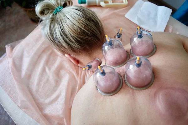 Penyembuhan Pertumpahan Darah Hijama Atau Phlebotomy Master Hajam Melakukan Terapi — Stok Foto