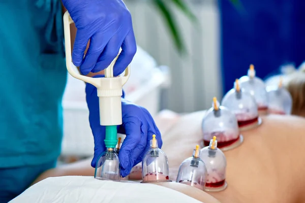 Sanguinamenti Hijama Flebotomia Hajam Master Conduce Una Terapia Coppettazione Una — Foto Stock