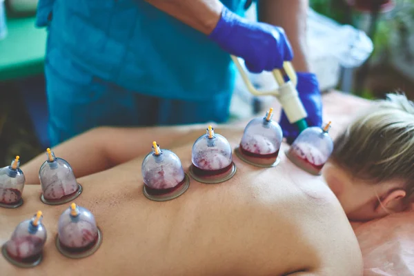 Muslim Hijama Ru