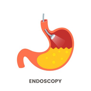 Stomach endoscopy is a flat cartoon endoscope in the stomach through the esophagus. Gastroscopy with light. flat vector illustration clipart