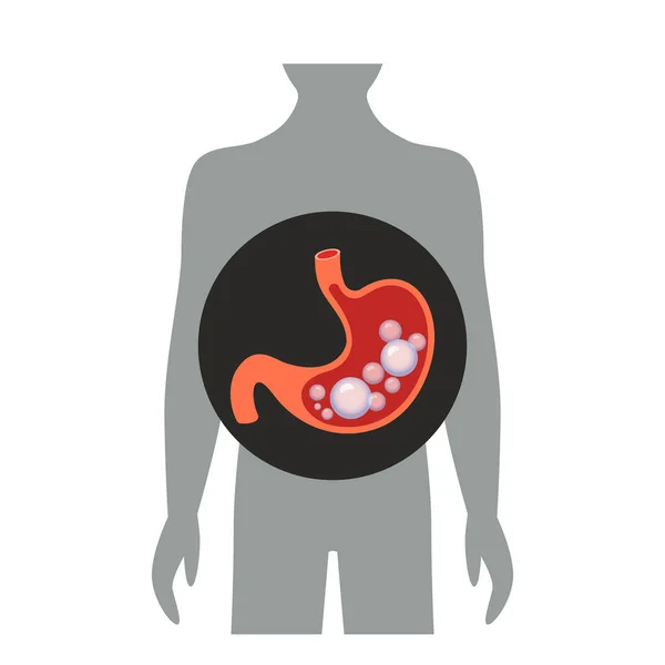 Estômago Cheio Gases Bolhas Ilustração Vetorial Plana Isolada Sobre Fundo —  Vetores de Stock