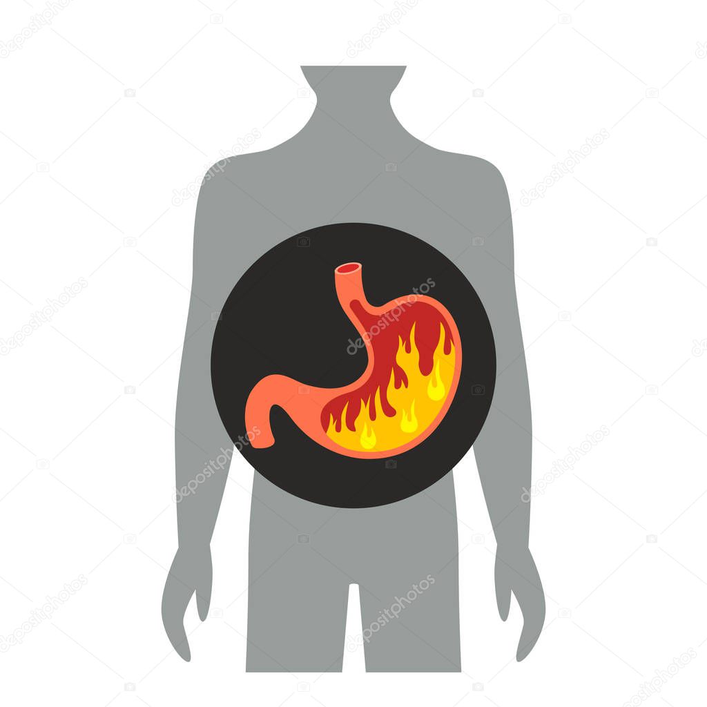 Heartburn in the stomach. flat vector illustration isolated on white background