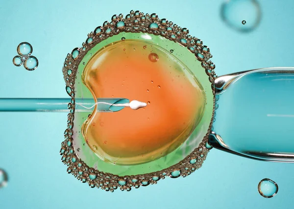 Ovum with needle and sperm for artificial insemination or in vitro fertilization. Concept of artificial insemination or fertility treatment. Image