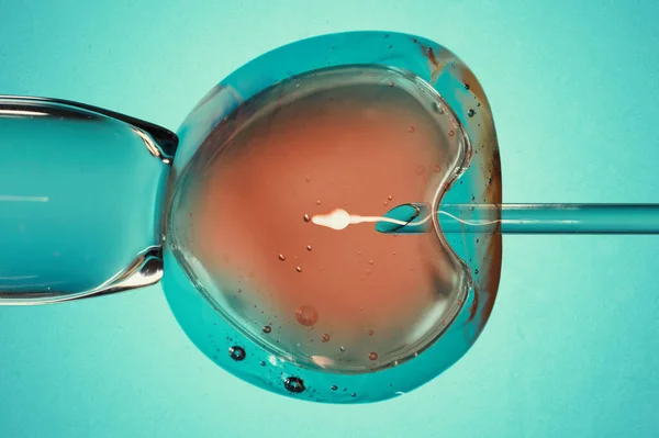 Ägg Med Nål Och Sperma För Artificiell Insemination Eller Vitro — Stockfoto