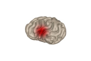 3d illüstrasyon. insan beyin kıvrımları ve nokta ağrısı
