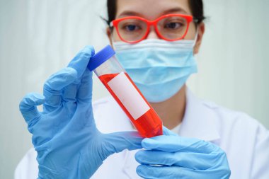 Doktor tiroid bezi modeli ve kan örneği tüpünü laboratuarda tutuyor..