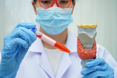 Doktor tiroid bezi modeli ve kan örneği tüpünü laboratuarda tutuyor..