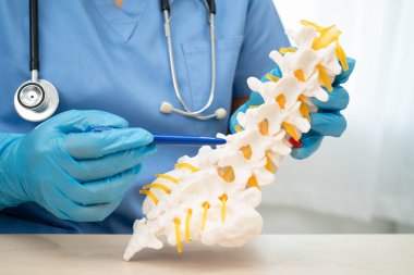 Omurga ve kemik modeli taşıyan Asyalı doktor, ortopedi bölümünde tedavi için bel kemiği yerinden oynamış disk parçası..