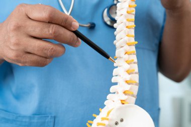 Omurga ve kemik modeli taşıyan Asyalı doktor, ortopedi bölümünde tedavi için bel kemiği yerinden oynamış disk parçası..