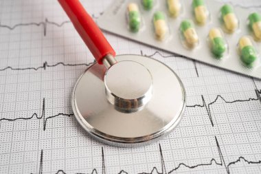 Elektrokardiyogram, EKG, kalp dalgası, kalp krizi, kardiyogram raporu.