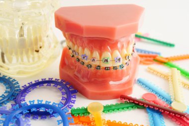 Ortodontik bağlar halkalar ve kravatlar, diş hekimliği üzerine çalışan dişçi için model..