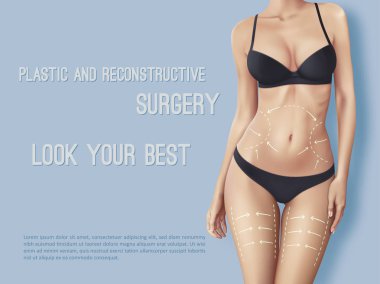 Güzel kadının vücut cerrahi satırlarda. Beyaz kadın slim fit vücut closeup cilt üzerinde hangi gösteri yerler plastik cerrahi işlemi için işaretler. Kız mükemmel seksi vücut şekli karanlık iç çamaşırı