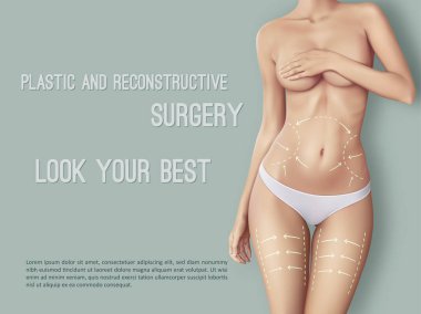 Güzel kadının vücut cerrahi satırlarda. Beyaz kadın slim fit vücut closeup cilt üzerinde hangi gösteri yerler plastik cerrahi işlemi için işaretler. Kız mükemmel seksi vücut şekli beyaz külot içinde.