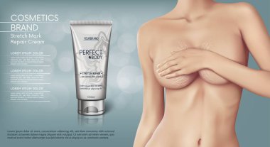Web banner design of Stretch mark removal cream. Concept vector illustration of skin care and with woman with stretch marks on breast clipart