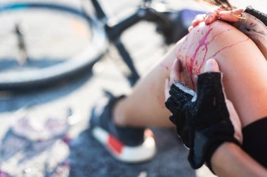 Kazadan yaralı ve yaralı adlı genç kadın bisikletçi çatıştılar