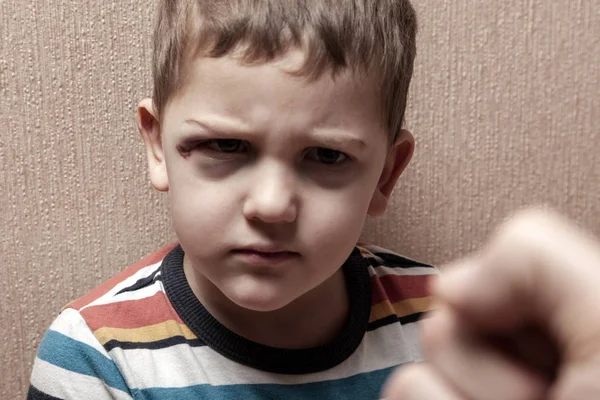 Violencia familiar. Abuso infantil. Niño triste con moretones bajo los ojos hombre adulto puño amenazante . — Foto de Stock