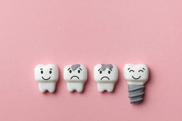 Dentes brancos saudáveis e implante estão sorrindo e o dente está doente com cárie triste no fundo rosa . — Fotografia de Stock