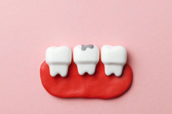 Healthy white teeth and tooth with caries on pink background.