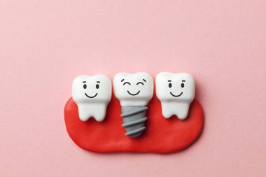 Sağlıklı beyaz dişler ve implantlar, pembe arka plan gülüyorsun.