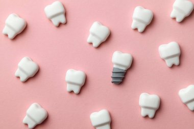 Sağlıklı dişler beyaz ve pembe bir arka plan üzerinde implantlar