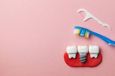 Diş fırçası ve diş ipi ile pembe arka planda sağlıklı beyaz dişler ve implantlar. Metin için boşluk Kopyala.