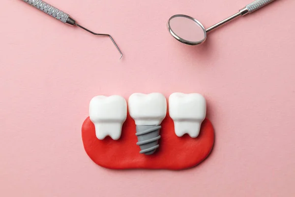 Dientes blancos saludables e implantes sobre fondo rosa y herramientas de dentista espejo, gancho . — Foto de Stock