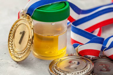 Doping testi. Altın, gümüş ve bronz madalya ve gri arka planda idrar analizi için bir kavanoz.