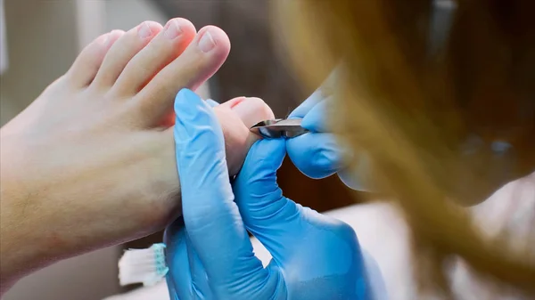在美容院用指甲钳在脚趾上切角质使足疗. — 图库照片