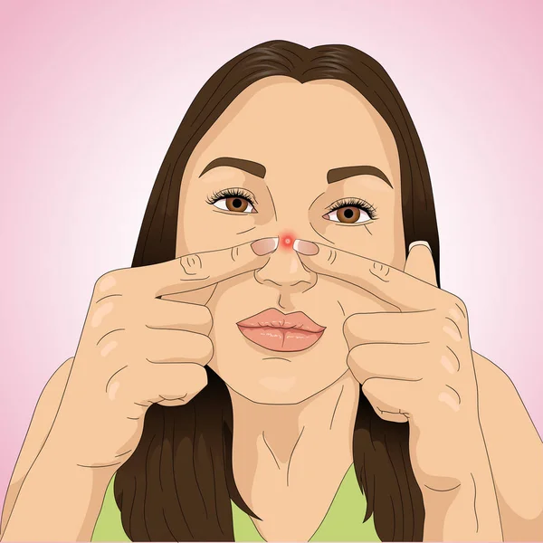 Ilustrasi Kartun Dari Seorang Wanita Yang Memiliki Masalah Jerawat Hidung - Stok Vektor