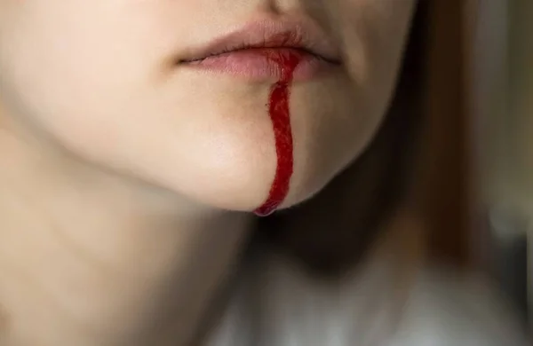 Κορίτσι Ματωμένο Χείλος Κλείσε — Φωτογραφία Αρχείου