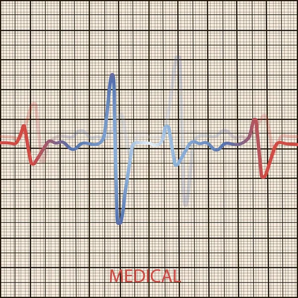 Концепція Кардіології Діаграмою Пульсу Медичний Фон Серцевою Кардіограмою — стоковий вектор