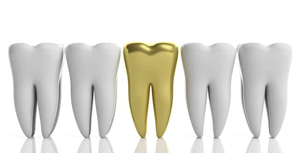 Tänder Hälsa Dentristy Koncept Vit Tand Modeller Och Guld Isolerad — Stockfoto