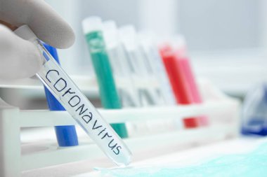 Laboratuvar test tüpü koronavirüs tanısı konsepti