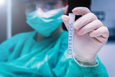 Eldivenle eldiven içinde tıbbi test tüpü tutarken, kovid19 'da kan pozitif çıktı. Salgın konsepti, kontaminasyon koronavirüsü önleme. 