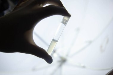 Eldivende tıbbi test tüpü, bulaşıcı koronavirüsü önleme salgını konsepti 